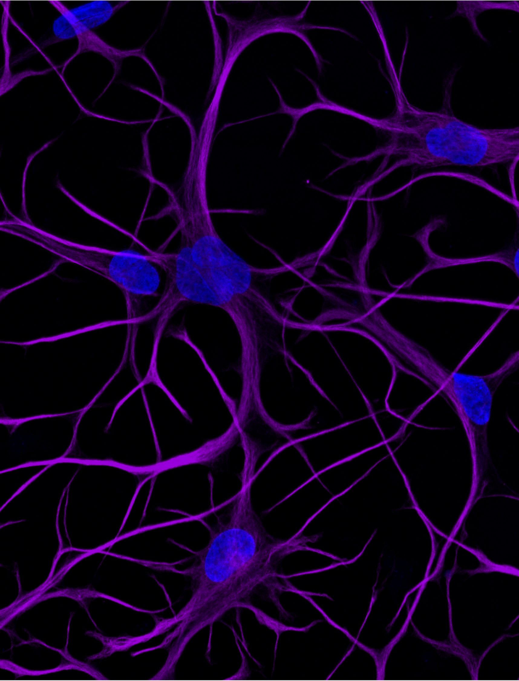 [ioEA1093] ioAstrocytes