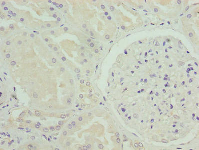 [CSB-PA015961LA01HU] NOX4 Antibody