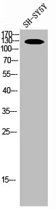 [CSB-PA003464] NOS2 Antibody