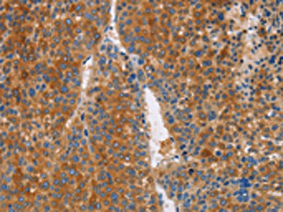 [CSB-PA242213] LTF Antibody