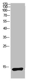 [CSB-PA801588] MAP1LC3B Antibody