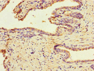 [CSB-PA897529LA01HU] MAST1 Antibody