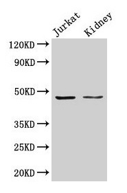 [CSB-PA00015A0Rb] ALDOA Antibody