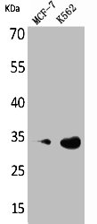 [CSB-PA005118] CDK4 Antibody