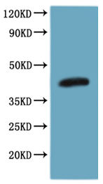 Recombinant Human C-C chemokine receptor type 8(CCR8)-VLPs (Active)