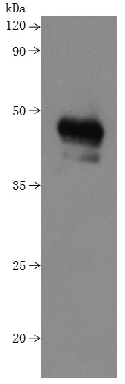 Recombinant Human B-lymphocyte antigen CD20(MS4A1)-VLPs (Active)