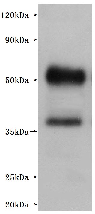 Recombinant Human C5a anaphylatoxin chemotactic receptor 1(C5AR1)-VLPs (Active)