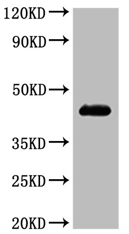 Recombinant Human C-C chemokine receptor type 4(CCR4)-VLPs (Active)