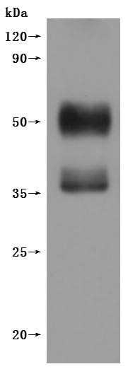 Recombinant Human C-X-C chemokine receptor type 4(CXCR4)-VLPs (Active)