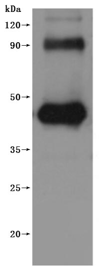 Recombinant Human G-protein coupled receptor family C group 5 member D(GPRC5D)-VLPs (Active)