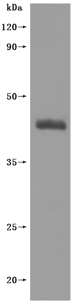 Recombinant Human Somatostatin receptor type 2(SSTR2)-VLPs (Active)