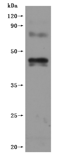 Recombinant Human Cannabinoid receptor 1(CNR1)-VLPs (Active)