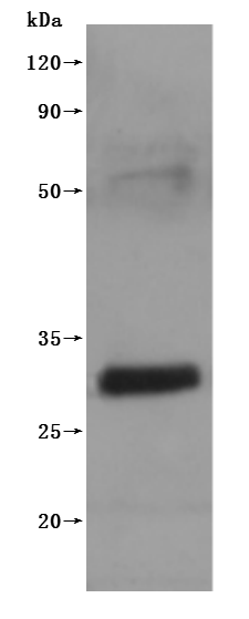 Recombinant Mouse Claudin-18(Cldn18)-VLPs (Active)