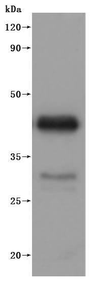 Recombinant Dog B-lymphocyte antigen CD20(MS4A1)-VLPs (Active)