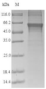 Recombinant Human Protein cereblon(CRBN)