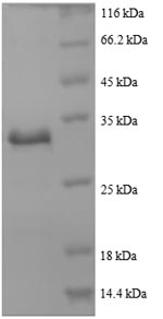 Recombinant Human Actin, cytoplasmic 1(ACTB),partial