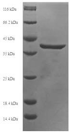 Recombinant Human DNA dC->dU-editing enzyme APOBEC-3A(APOBEC3A)