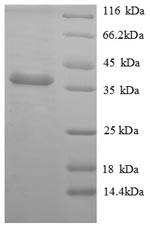 Recombinant Mouse Apolipoprotein E(Apoe)