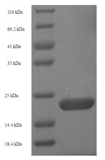 Recombinant Human Aquaporin-4(AQP4),partial