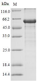 Recombinant Human Androgen receptor(AR) ,partial