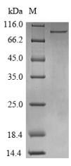 Recombinant Human ATP-dependent RNA helicase DDX3X(DDX3X)