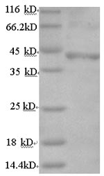 Recombinant Human Follicle-stimulating hormone receptor(FSHR),partial