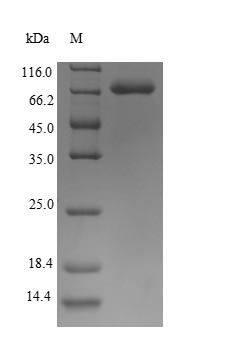 Recombinant Human Keratin, type I cytoskeletal 10(KRT10)