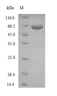 Recombinant Human Neurofilament heavy polypeptide(NEFH),partial