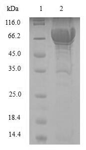 Recombinant Human Phenylalanine-4-hydroxylase(PAH)