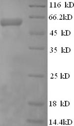 Recombinant Human Perforin-1(PRF1)