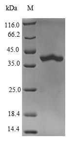 Recombinant Mouse Ras-related protein Rab-10(Rab10)