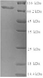 Recombinant Human Probable global transcription activator SNF2L2(SMARCA2),partial