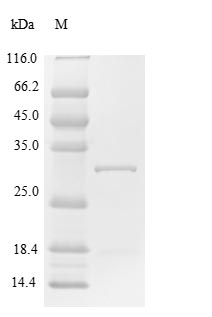 Recombinant Human Suppressor of cytokine signaling 1(SOCS1)