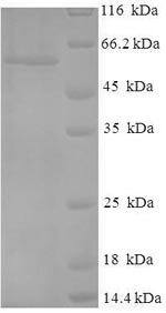 Recombinant Human Cellular tumor antigen p53(TP53)