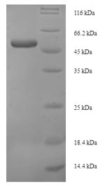 Recombinant Human Protein Wnt-4(WNT4)