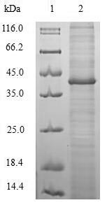 Recombinant Helicobacter pylori Cytotoxicity-associated immunodominant antigen(cagA),partial