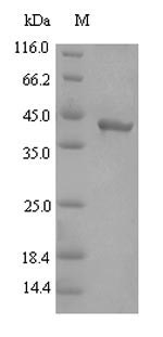 Recombinant Porphyromonas gingivalis Gingipain R2(rgpB),partial