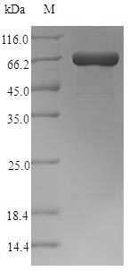 Recombinant Clostridium perfringens Perfringolysin O(pfo)