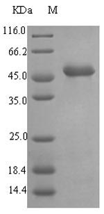 Recombinant Pseudomonas aeruginosa Elastase(lasB)