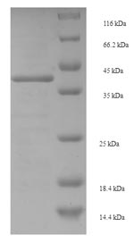 Recombinant Staphylococcus aureus Enterotoxin type E(entE)