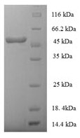 Recombinant Human HLA class I histocompatibility antigen, alpha chain E(HLA-E) ,partial