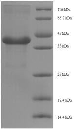 Recombinant Nicotiana tabacum Osmotin(AP24)