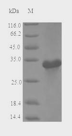 Recombinant Malus domestica Major allergen Mal d 1(MALD1)