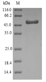 Recombinant Haemophilus influenzae Outer membrane protein P5(ompA) 