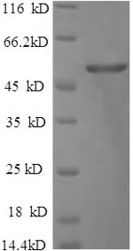 Recombinant Salmonella typhimurium Outer membrane porin protein OmpD(ompD