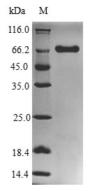 Recombinant Porphyromonas gingivalis Gingipain R1(rgpA),partial