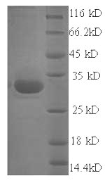 Recombinant Staphylococcus aureus Exfoliative toxin A(eta)