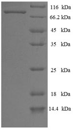 Recombinant Influenza B virus Nucleoprotein(NP) 