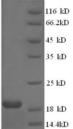 Recombinant Human papillomavirus type 18 Protein E7(E7)