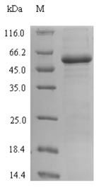 Recombinant Escherichia coli Lactose operon repressor(lacI)